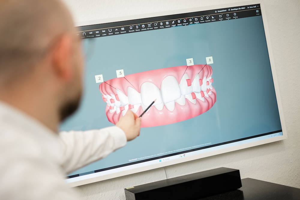 pham-miehe-privatpraxis-invisalign-duesseldorf-digitale-behandlung-v1 pham-miehe- privatpraxis-invisalign-duesseldorf-digitale-behandlung-v1
