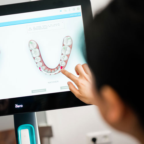 pham-miehe-privatpraxis-invisalign-duesseldorf-gallerie06-v2 pham-miehe- privatpraxis-invisalign-duesseldorf-gallerie06-v2