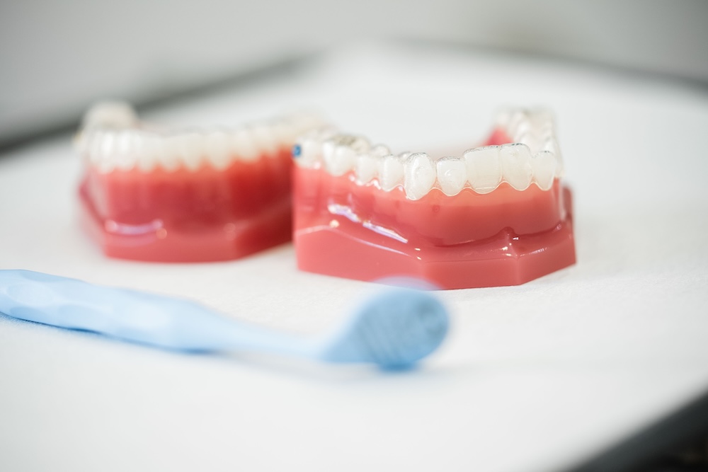 pham-miehe-privatpraxis-invisalign-duesseldorf-kurzzeit-aligner-v1 pham-miehe- privatpraxis-invisalign-duesseldorf-kurzzeit-aligner-v1
